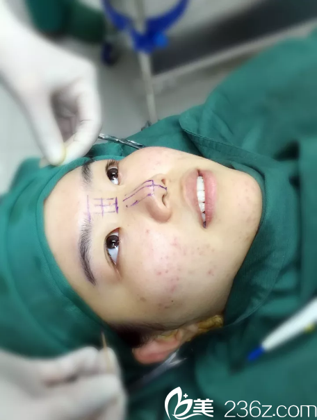 寧波和波珀悅設(shè)計的鼻手術(shù)方案