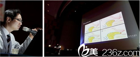 張院長發(fā)表眼底脂肪再排至演講
