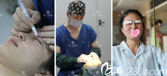 手術(shù)過程其實(shí)不疼