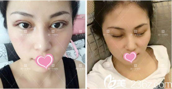 雖然沒有恢復(fù)還是可以的