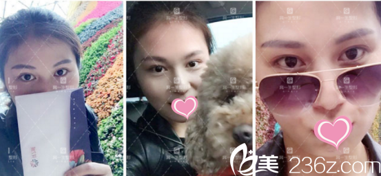 恢復(fù)的挺快的