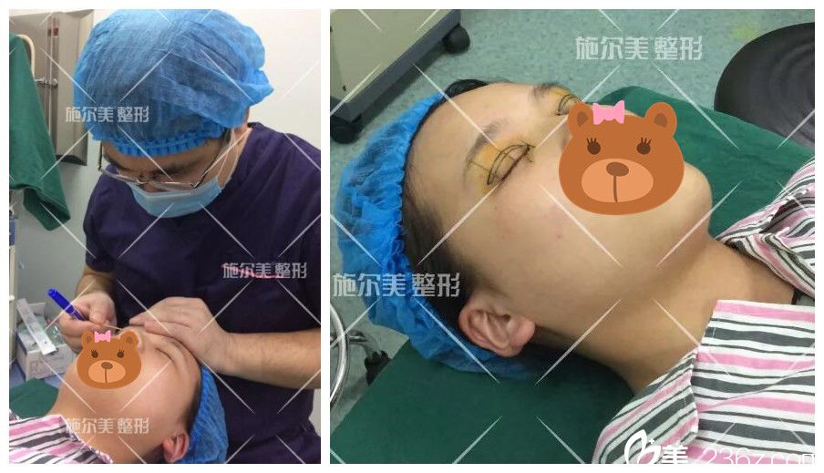 眼綜合設(shè)計劃線過程中 眼綜合設(shè)計劃線過程中