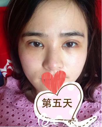 差不多能好點(diǎn)