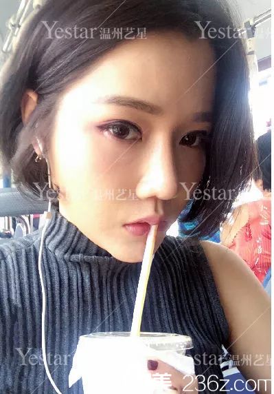 溫州藝興鼻綜合整形14天<span style=