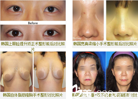 KIES-U整形外科醫(yī)院整形案例 KIES-U整形外科醫(yī)院整形案例