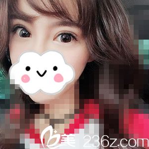 術后第15天的我