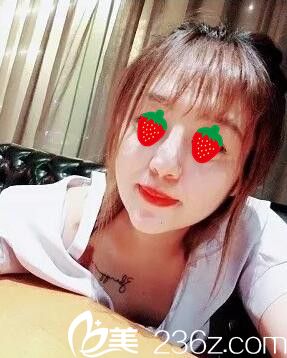 術(shù)后一周拆線淡妝樣子 術(shù)后一周拆線淡妝樣子