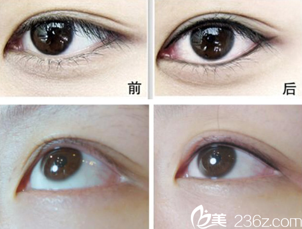 紀(jì)輝院長紋眼線真人<span style= 紀(jì)輝院長紋眼線真人<span style=