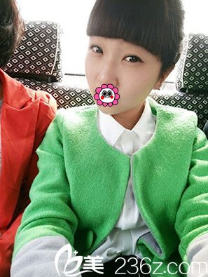 整形做雙眼皮+開(kāi)眼角只要7520元就能美上天