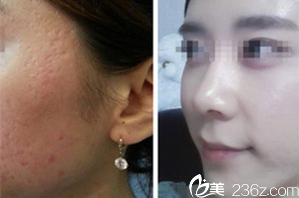 韓國陳整形外科醫(yī)院院長陳世勛案例 韓國陳整形外科醫(yī)院院長陳世勛案例