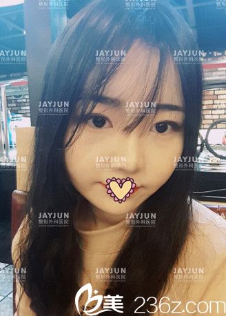 第八天了，恢復(fù)蠻不錯(cuò)