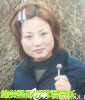 締萊美整形院長郭芮君 締萊美整形院長郭芮君