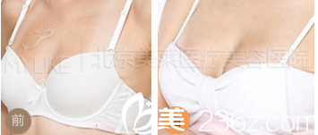 北京美萊醫(yī)療美容醫(yī)院案例