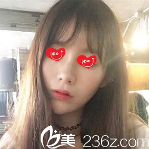 我去韓國(guó)陳整形找了陳世勛院長(zhǎng)之后才發(fā)現(xiàn)其實(shí)祛痘坑也沒(méi)那么難