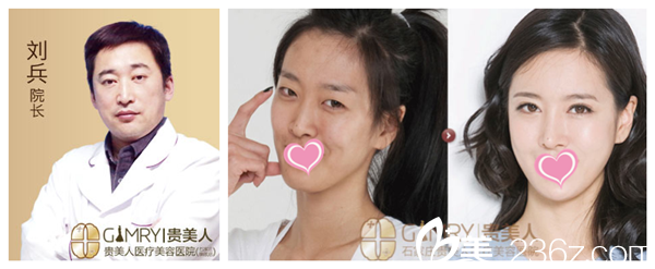 石家莊貴美人整形醫(yī)院院長劉兵