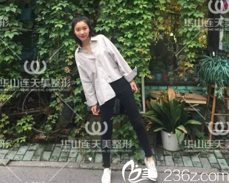 注射玻尿酸填充第7天旅行照片 注射玻尿酸填充第7天旅行照片