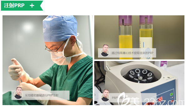 廣州倍生植發(fā)采用精密器械進(jìn)行PRP注射