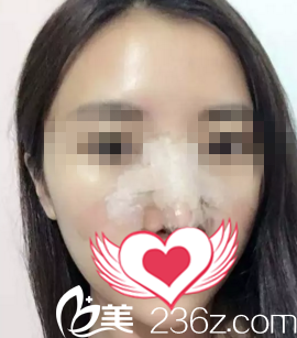 術(shù)后第三天狀況