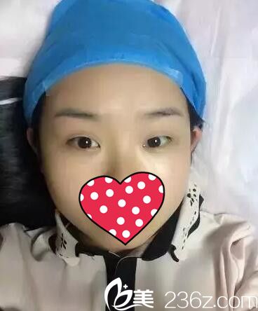 做雙眼皮術(shù)前一只眼大一只眼小 做雙眼皮術(shù)前一只眼大一只眼小