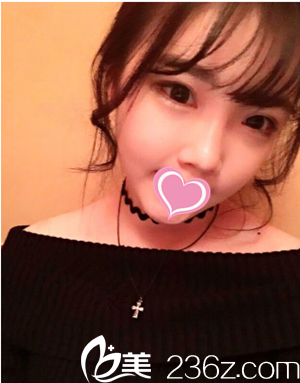 術后三個月 術后三個月