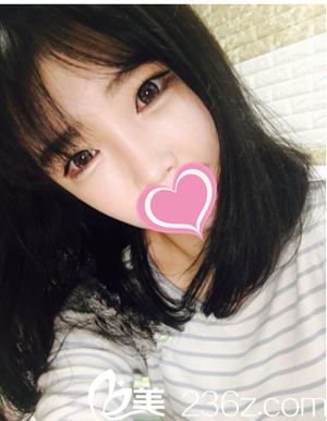 術后半年 術后半年