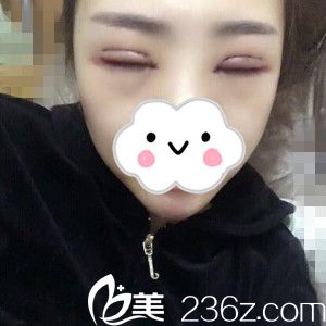 術(shù)后第三天 術(shù)后第三天