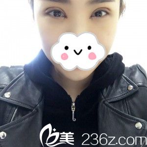 手術(shù)后第七天 手術(shù)后第七天