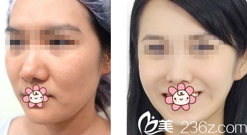 蘭州明倫整形效果 蘭州明倫整形效果