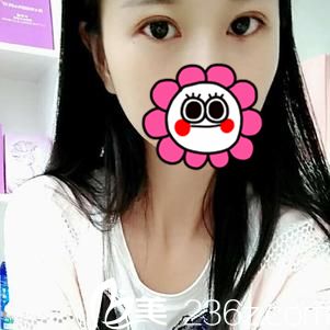 術(shù)后14天效果 術(shù)后14天效果