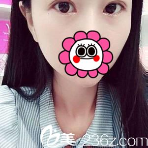 術(shù)后21天效果 術(shù)后21天效果