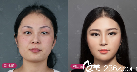 西安高一生<span style=