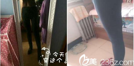 現(xiàn)在已經(jīng)瘦了很明顯了 現(xiàn)在已經(jīng)瘦了很明顯了