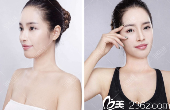 隆鼻后秒變女神