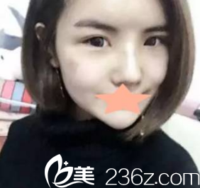 術(shù)后真的是美美噠的