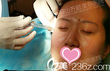 玻尿酸豐太陽(yáng)穴 玻尿酸豐太陽(yáng)穴