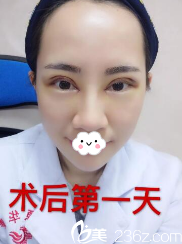 河源華美何為院長(zhǎng)雙眼皮天 河源華美何為院長(zhǎng)雙眼皮天