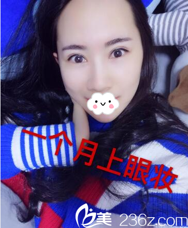 找何為院長(zhǎng)做完雙眼皮1個(gè)月自拍 找何為院長(zhǎng)做完雙眼皮1個(gè)月自拍