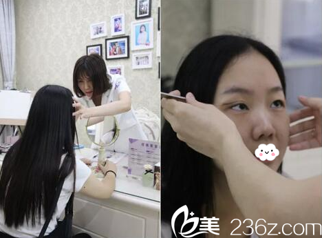 揭陽華美設計師雙眼皮設計中