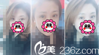 術(shù)后半個月恢復(fù)情況