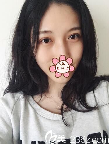 術(shù)后一周拆線 術(shù)后一周拆線