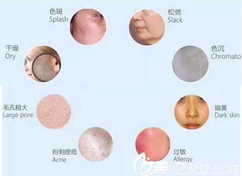 糟糕的皮膚狀態(tài)