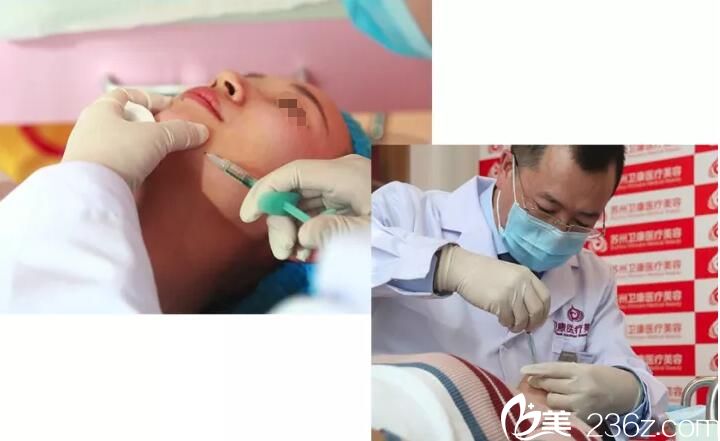 艾莉薇玻尿酸注射下巴 艾莉薇玻尿酸注射下巴