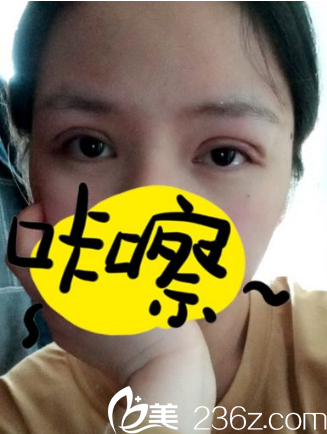 術(shù)后第二天