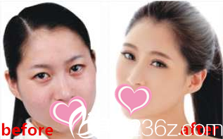 面部整體形象設(shè)計(jì)前后對(duì)比