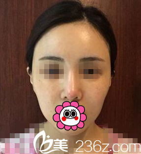 術(shù)前照 術(shù)前照