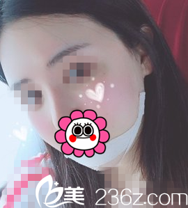 術(shù)后第十天回國 術(shù)后第十天回國