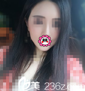 術(shù)后3個月恢復(fù)效果 術(shù)后3個月恢復(fù)效果