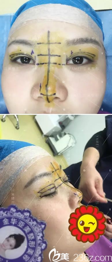 金華亞美院長為小王設(shè)計手術(shù)方案