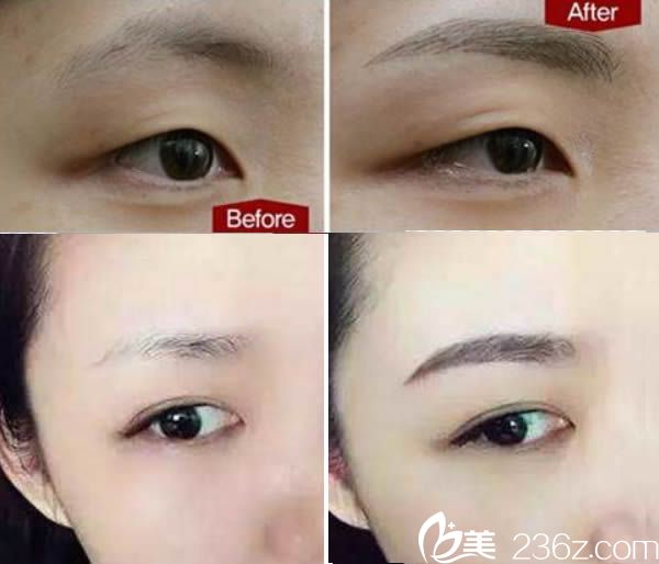 廈門華美陳燕喜半紋眉前后對比案例 廈門華美陳燕喜半紋眉前后對比案例