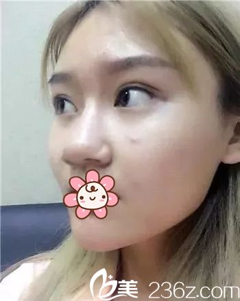 我去韓國Dr.朵整形外科醫(yī)院之前 我去韓國Dr.朵整形外科醫(yī)院之前